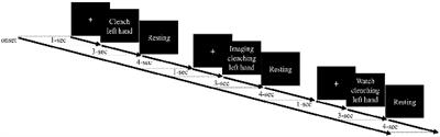 The Sensitivity of Single-Trial Mu-Suppression Detection for Motor Imagery Performance as Compared to Motor Execution and Motor Observation Performance